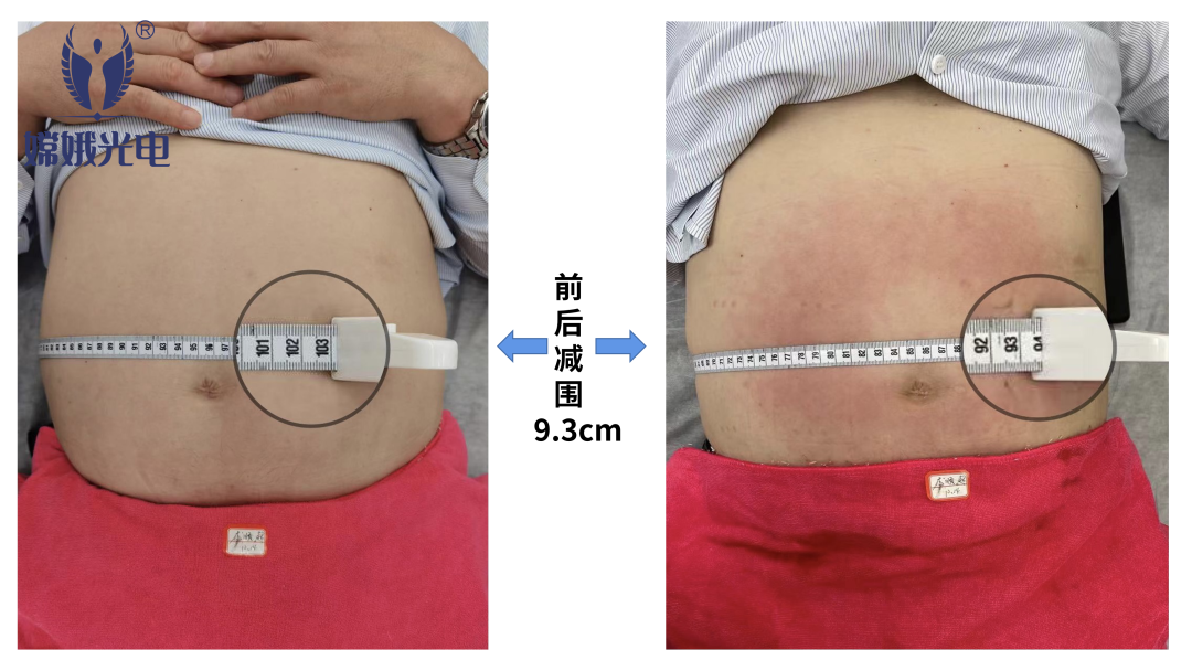 减肥黑科技——嫦娥爆脂机器人要你好看!(图22) 296eee061a6574ed5644bb4a37c16710.png
