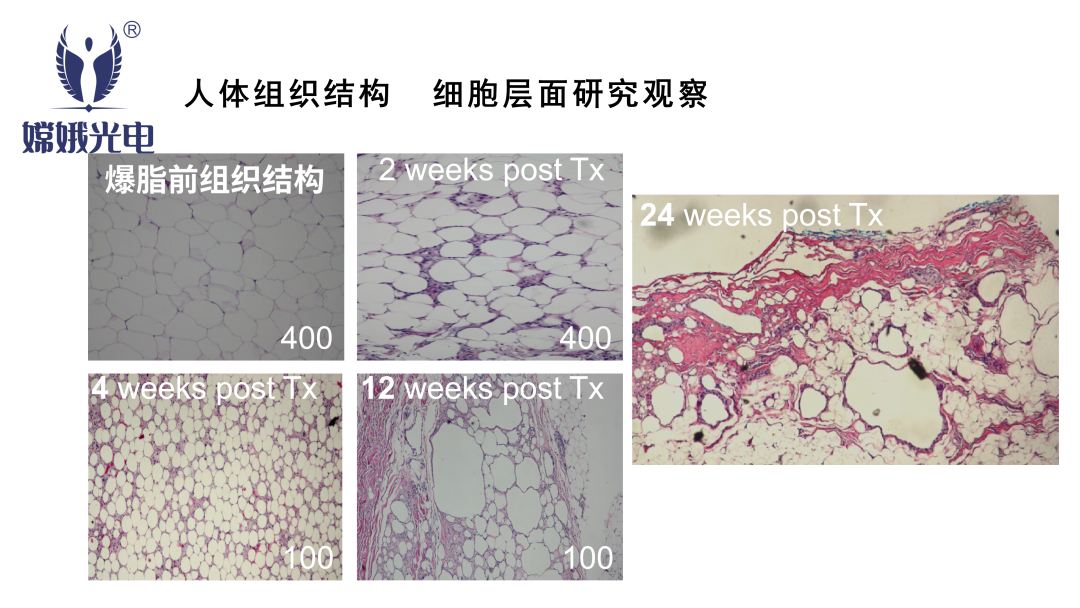 减肥黑科技——嫦娥爆脂机器人要你好看!(图13) 8d06b4785f753fcf8ffd888303df4269.png